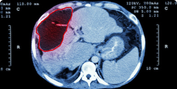 의료 객체 검출